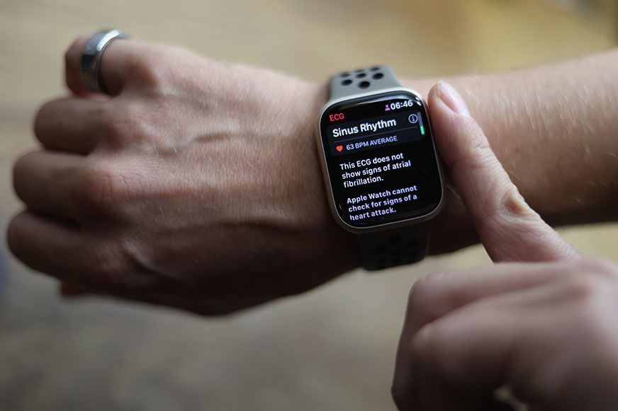 Man sieht die EKG-Funktion der Apple Watch 8.